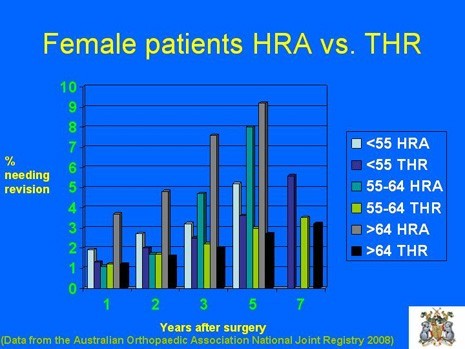 Graph of Female Patients with HRA vs. THR by age