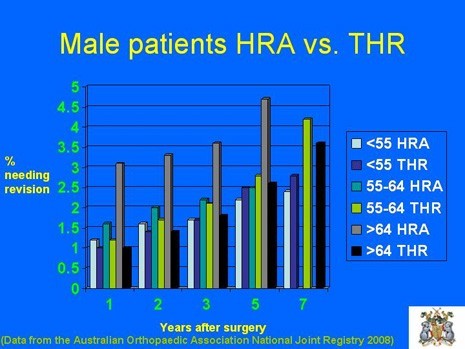 Graph of Male Patients with HRA vs. THR by age