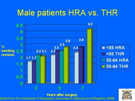 Graph of Male Patients with HRA vs. THR, at 3 to 7 years